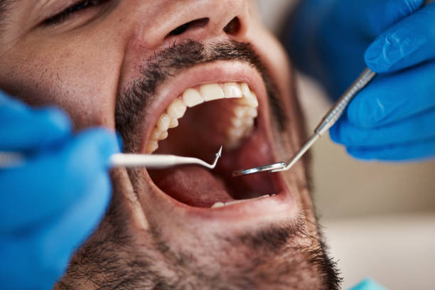Best Wisdom Tooth Removal  in Southfield, MI